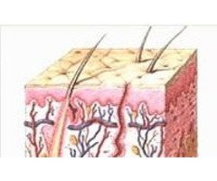 Blemish Removal Product to Remove Cherry Angioma - 2