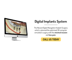 Dental Implants in Perth - 2