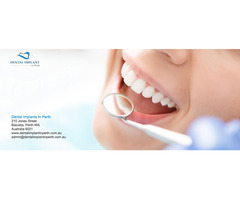 Dental Implants in Perth - 3