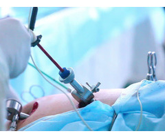 Laparoscopic Surgeon in Jaipur