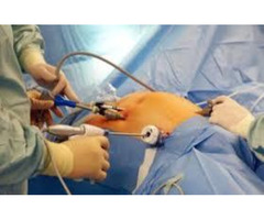 Laparoscopic Surgeon in Jaipur - 2