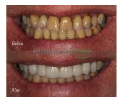 Platinum Smile Dentist Mandurah