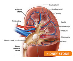 Best Nephrologist in Patna Bihar: Dr. Kumar Rajesh Ranjan - 2