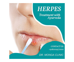 Fastest Way to Cure Herpes - Dr Monga