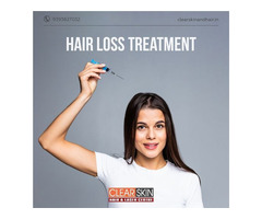 Hair Transplant Treatment in India
