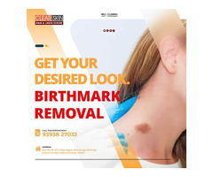 Skin Pigmentation Removal Treatment