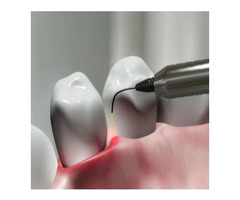 Laser Dental Treatment in AECS Layout