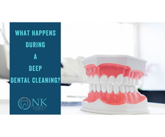 Teeth Cleaning in Chicago