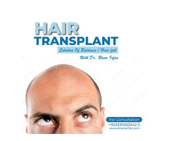 Hair Transplant Services Islamabad