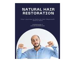 Hair Restoration Services in Islamabad Pakistan
