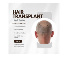 Hair Transplant Treatment in Islamabad Pakistan