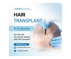 Hair Transplant Services in Pakistan