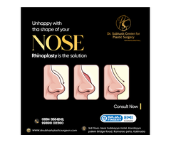 Rhinoplasty in Banjara Hills