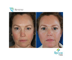Skin Tightening Doctors in Faridabad -Revyve Care