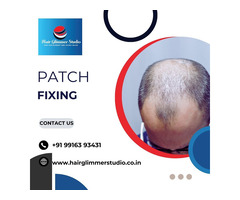 Hair Patch Fixing in Bangalore-Hair Patch in Bangalore - 2