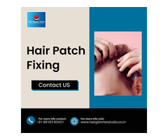 Hair Patch Fixing in Bangalore-Hair Patch in Bangalore - 3