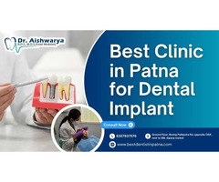 Best Dental Implant Clinic in Patna - 2