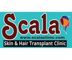 Best Hair Transplant Clinic in Hyderabad