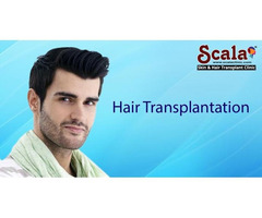 Low Cost Hair Transplant in Hyderabad|Best Hair T