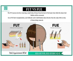 Get Quality FUE Hair Transplant, Islamabad