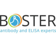 Get the Elisa Test Done by Professionals