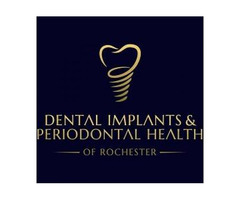 Dental Implants & Periodontal Health