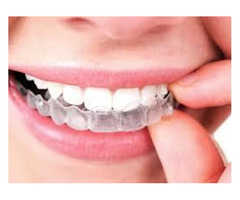 Wear right braces and smile with no care