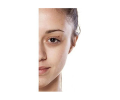 Permanent Makeup Brows