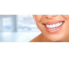 Find Best Cosmetic Dentists in San Diego
