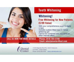 Recommended Tooth Whitening North Hollywood