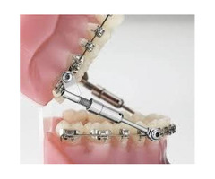 Florida Orthodontic Specialists