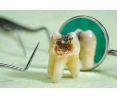 Quality Care Holistic Pediatric Dentistry with Dr. Memoli