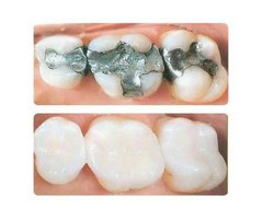 Top Berkeley Heights, NJ Dentist - Dr. Philip Memoli