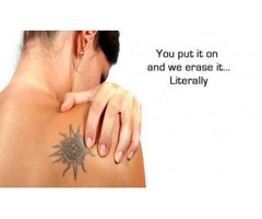 Tattoo removal fort lauderdale