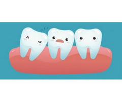 San Diego Wisdom Tooth Removal
