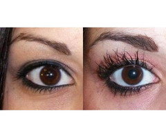 Look Younger with Eyelid Surgery in Wisconsin