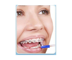 Latest Braces Treatments