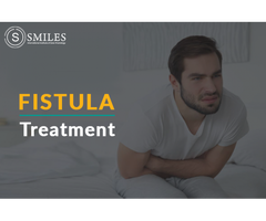 Best Fistula Treatment in Bangalore - Smiles IICP