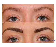 Eyebrow Hair Transplant in kerala