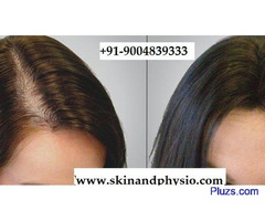 BEST TREATMENT FOR HAIR LOSS