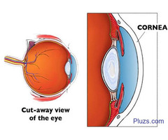 Best Cornea Specialist in Bangalore