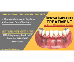 Dental Implant Treatment in Brampton