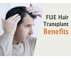 Hair Transplant in Hitech City |Hyderabad | Madhapur