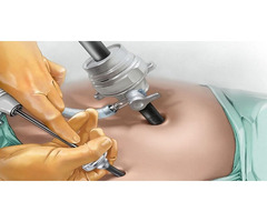 Best Laparoscopic Surgeon in Bangalore