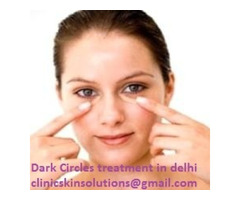 Dark Circles treatment in delhi