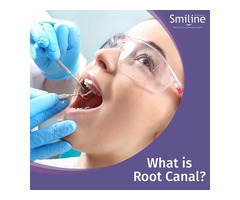 Dental clinics in hyderabad