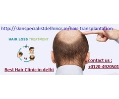 Best Hair transplant surgeon in delhi