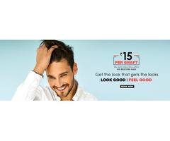 Best hair transplant in pune
