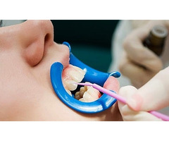 Family Dentist Modesto CA