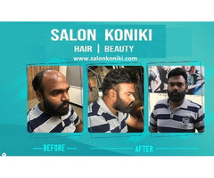 Hair styling Permanent hair patch treatment in hyderabad